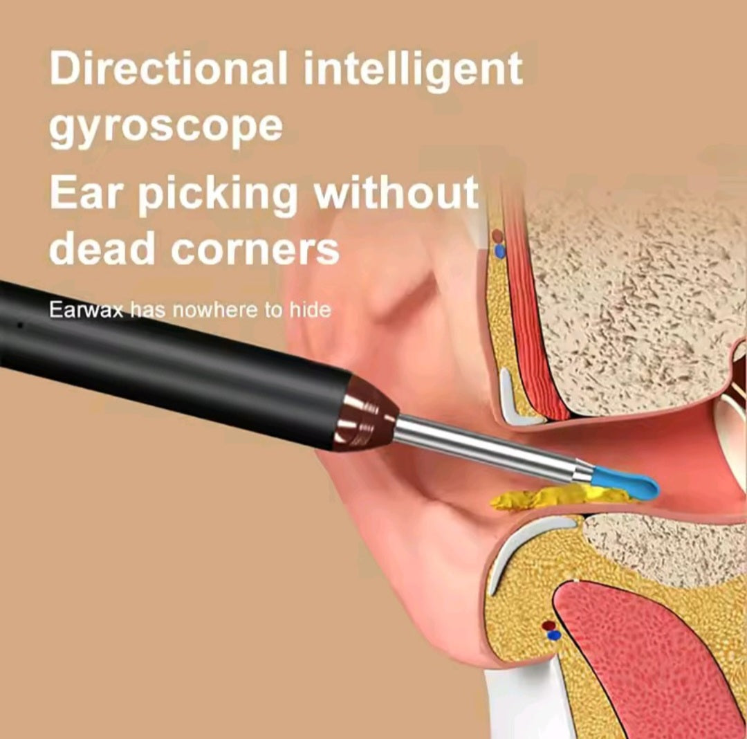 Smart Visual Ear Cleaner - Rechargeable Ear Wax Removal with Camera Ear Sticks USB C Charging WIFI Connection 6 LED Lights Earpick Daily White Black Nine Piece Set