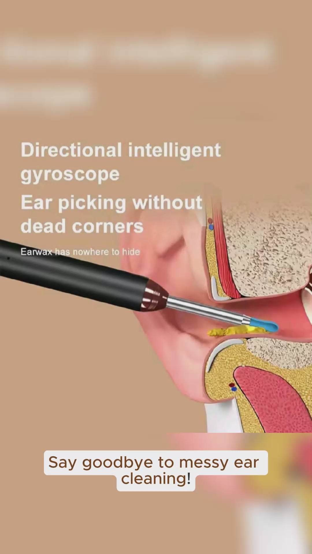 Smart Visual Ear Cleaner - Rechargeable Ear Wax Removal with Camera Ear Sticks USB C Charging WIFI Connection 6 LED Lights Earpick Daily White Black Nine Piece Set